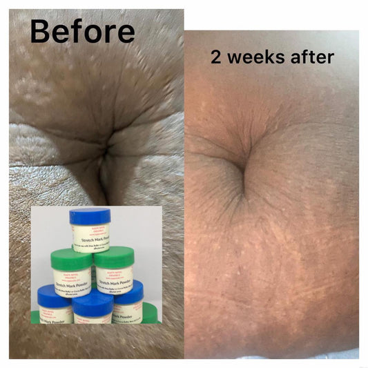 Organic Stretch Mark Support Powder